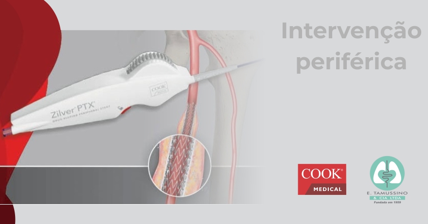 Zilver PTX vs. Balão Farmacológico (Intervenção Periférica)