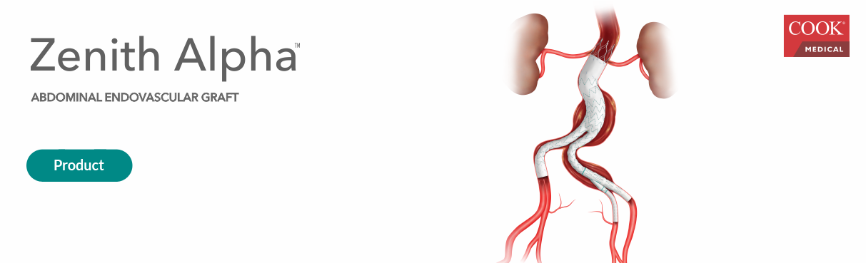 enxerto-endovascular-abdominal